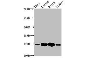 Western Blot Positive WB detected in: K562 whole cell lysate, Rat kideny tissue, Rat brain tissue, Mouse kidney tissue All lanes: HBG2 antibody at 4. (HBG2 Antikörper  (AA 2-147))