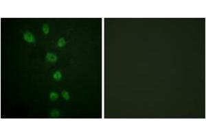 Immunofluorescence analysis of HepG2 cells, using GATA4 (Phospho-Ser105) Antibody. (GATA4 Antikörper  (pSer105))