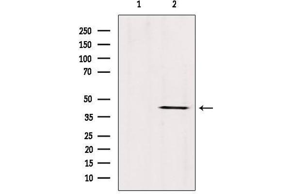 ABHD13 Antikörper  (Internal Region)