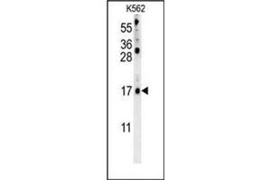 LCE2B Antikörper  (C-Term)