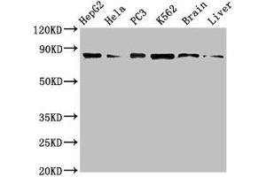 Western Blot Positive WB detected in: HepG2 whole cell lysate, Hela whole cell lysate, PC-3 whole cell lysate, K562 whole cell lyaste, Mouse brain tissue, Rat liver tissue All lanes: STAT4 antibody at 1 μg/mL Secondary Goat polyclonal to rabbit IgG at 1/50000 dilution Predicted band size: 86 kDa Observed band size: 86 kDa (STAT4 Antikörper  (AA 569-748))