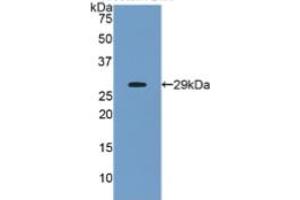 WB of Protein Standard: different control antibodies against Highly purified E. (ANGPTL2 ELISA Kit)