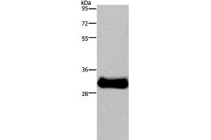Western Blot analysis of Mouse skeletal muscle tissue using FHL3 Polyclonal Antibody at dilution of 1:1600 (FHL3 Antikörper)