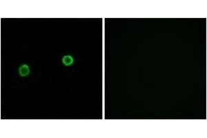 Immunofluorescence analysis of MCF7 cells, using ACOT4 Antibody.