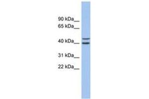 Image no. 1 for anti-F-Box and Leucine-Rich Repeat Protein 14 (FBXL14) (AA 35-84) antibody (ABIN6743688) (FBXL14 Antikörper  (AA 35-84))