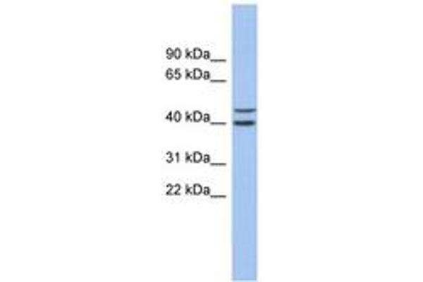 FBXL14 Antikörper  (AA 35-84)