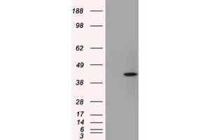 Image no. 3 for anti-Acetyl-CoA Acetyltransferase 2 (ACAT2) antibody (ABIN1496402) (ACAT2 Antikörper)