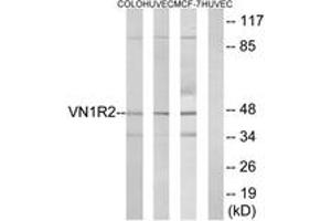 Western blot analysis of extracts from HuvEc/COLO/MCF-7 cells, using VN1R2 Antibody. (VN1R2 Antikörper  (AA 88-137))
