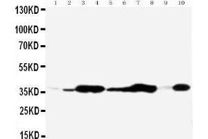 Anti-Annexin V antibody, Western blotting All lanes: Anti Annexin V  at 0.