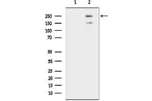 anti-SET Domain Containing 1B (SETD1B) antibody