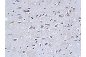 Formalin-fixed and paraffin embedded mouse brain tissue labeled with Rabbit Anti-NF-H/Neurofilament H/Neurofilament 200 Polyclonal Antibody (ABIN672156), Unconjugated followed by conjugation to the secondary antibody and DAB staining