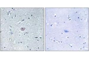Immunohistochemistry (IHC) image for anti-VEGF Receptor 2 (VEGFR2) (AA 917-966) antibody (ABIN2889081) (VEGFR2/CD309 Antikörper  (AA 917-966))