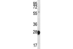 RAB27B antibody western blot analysis in MDA-MB435 lysate.