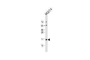 Anti-CRABP1 Antibody (C-term) at 1:1000 dilution + MOLT-4 whole cell lysate Lysates/proteins at 20 μg per lane.