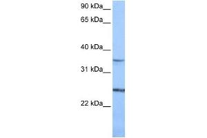 PIGF antibody used at 1 ug/ml to detect target protein.