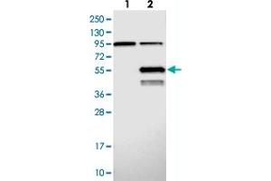 Western blot analysis of Lane 1: Negative control (vector only transfected HEK293T lysate), Lane 2: Over-expression Lysate (Co-expressed with a C-terminal myc-DDK tag (~3. (ABHD2 Antikörper)