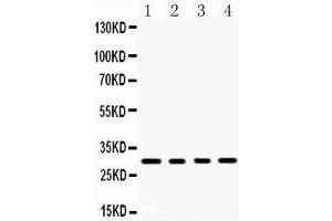 Western Blotting (WB) image for anti-Tumor Necrosis Factor (Ligand) Superfamily, Member 13b (TNFSF13B) (AA 134-285) antibody (ABIN3043751) (BAFF Antikörper  (AA 134-285))