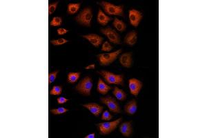 Immunofluorescence analysis of NIH/3T3 cells using DBI Rabbit pAb (ABIN6127407, ABIN6139420, ABIN6139422 and ABIN6217234) at dilution of 1:100 (40x lens). (Diazepam Binding Inhibitor Antikörper  (AA 1-114))