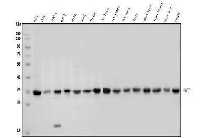 Western blot analysis of MCU using anti-MCU antibody (ABIN7601931).