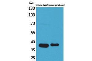 Western Blotting (WB) image for anti-Aldolase C, Fructose-Bisphosphate (ALDOC) (N-Term) antibody (ABIN3178215) (ALDOC Antikörper  (N-Term))