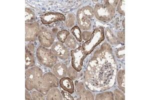 Immunohistochemical staining of human kidney with ZC3H12A polyclonal antibody  shows strong cytoplasmic positivity in cells in tubules at 1:200-1:500 dilution.