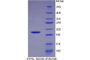 SDS-PAGE analysis of Human Interleukin 17 Protein. (IL-17 Protein)