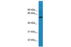WB Suggested Anti-CNDP1 Antibody Titration: 0.