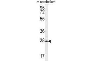 VSTM2A Antibody (Center) western blot analysis in mouse cerebellum tissue lysates (35 µg/lane). (VSTM2A Antikörper  (Middle Region))