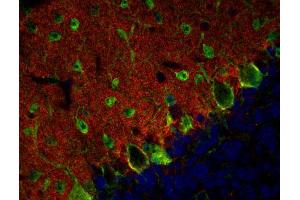 Immunohistochemistry (IHC) image for anti-Solute Carrier Family 1 (Neuronal/epithelial High Affinity Glutamate Transporter, System Xag), Member 1 (SLC1A1) (AA 487-500), (Cytoplasmic Domain) antibody (ABIN1742507)