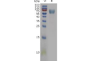 Human IL18BP Protein, hFc Tag on SDS-PAGE under reducing condition.