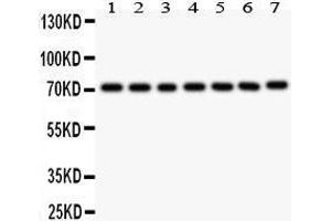 Anti- FOXO3A antibody, Western blotting All lanes: Anti FOXO3A  at 0. (FOXO3 Antikörper  (AA 471-673))
