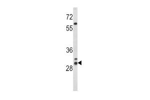 Western Blotting (WB) image for anti-Major Histocompatibility Complex, Class II, DR beta 1 (HLA-DRB1) (AA 30-58) antibody (ABIN390872)