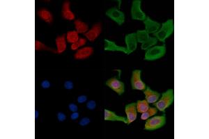 ABIN6263290 and ABIN6266589 staining HepG2 cells by IF/ICC. (MMP1 Antikörper  (C-Term))