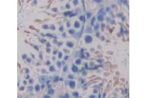 IHC-P analysis of Human Tissue, with DAB staining. (UGT8 Antikörper  (AA 198-541))