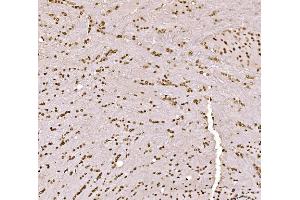 IHC analysis of SPHK1 using anti-SPHK1 antibody (ABIN7600168). (SPHK1 Antikörper  (AA 16-267))