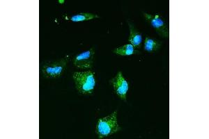IF analysis of SLC2A9 using anti-SLC2A9 antibody (ABIN7602338).