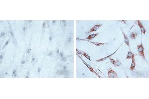IHC of human skin fibroblasts (Left: control, Right: 24 hours after 7th passage of senescence). (HSPD1 Antikörper)