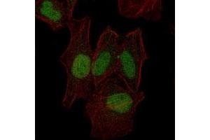 Immunofluorescence analysis of HeLa cells using MAP2K7 monoclonal antibody, clone 4E5  (green). (MAP2K7 Antikörper)