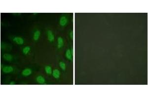 Immunofluorescence analysis of HeLa cells, using AML1 (Ab-303) Antibody. (RUNX1 Antikörper  (AA 269-318))