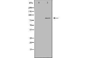 Western blot analysis of extracts of colo , using CHAT antibody. (Choline Acetyltransferase Antikörper  (C-Term))