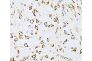 Immunohistochemistry (Paraffin-embedded Sections) (IHC (p)) image for anti-Neuregulin 4 (NRG4) antibody (ABIN7260591)