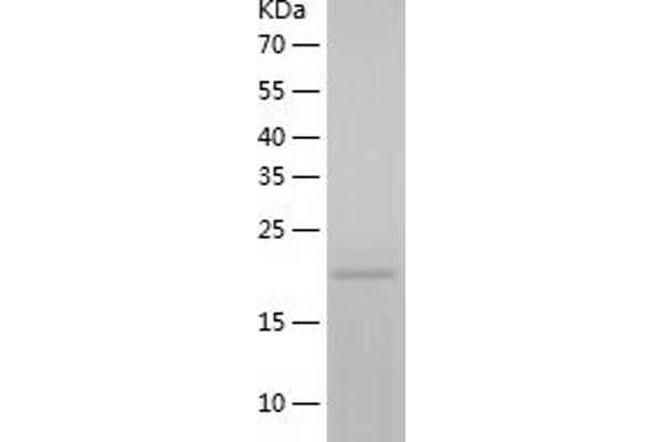 CSRP2 Protein (AA 1-193) (His tag)