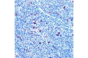 Immunohistochemistry (IHC) image for anti-Fibroblast Growth Factor 21 (FGF21) antibody (ABIN1680154)