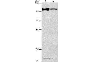 Western blot analysis of Lovo cell and human fetal brain tissue, using ADCY3 Polyclonal Antibody at dilution of 1:312. (ADCY3 Antikörper)
