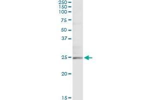 Immunoprecipitation of TWIST1 transfected lysate using anti-TWIST1 monoclonal antibody and Protein A Magnetic Bead , and immunoblotted with TWIST1 MaxPab rabbit polyclonal antibody. (TWIST1 Antikörper  (AA 106-174))