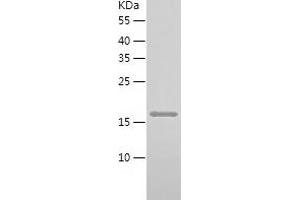 Western Blotting (WB) image for Calcineurin B (CAN) (AA 1-170) protein (His tag) (ABIN7122078)