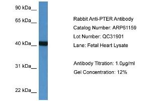 Western Blotting (WB) image for anti-Phosphotriesterase Related (PTER) (N-Term) antibody (ABIN2788700) (PTER Antikörper  (N-Term))