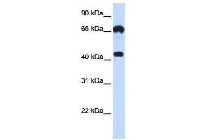 GUCY1B3 antibody used at 1 ug/ml to detect target protein. (GUCY1B3 Antikörper  (N-Term))