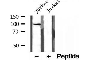 Western blot analysis of extracts of Jurkat cells, using NOD2 antibody.