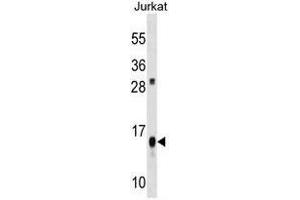 ATP5D Antibody (C-term) western blot analysis in Jurkat cell line lysates (35µg/lane). (ATP5F1D Antikörper  (C-Term))